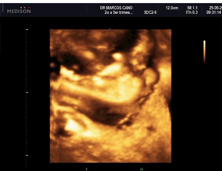 Marcos Javier Cano Luna-0