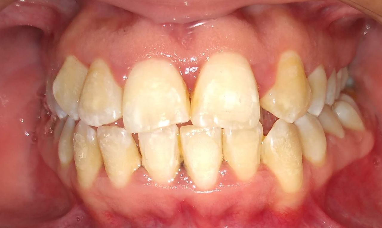 Yaneth Gutiérrez Sánchez-34