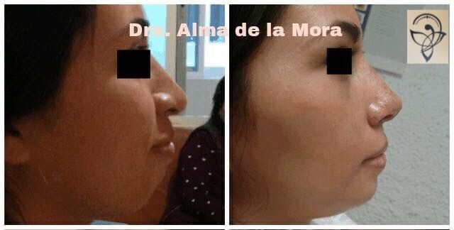 Alma Aidee De La Mora Jimenez-4