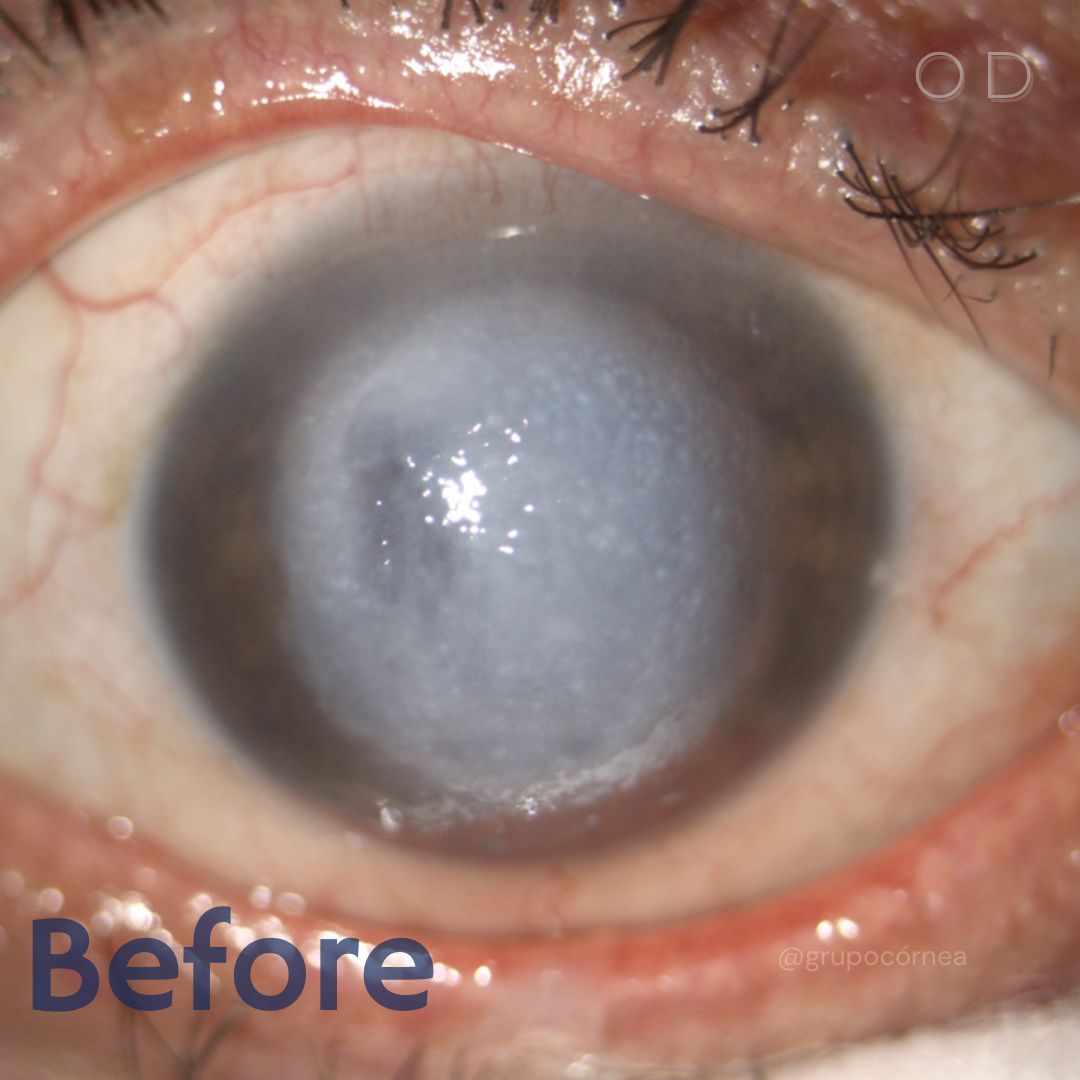 Kristian Alfonso Vazquez Romo-3