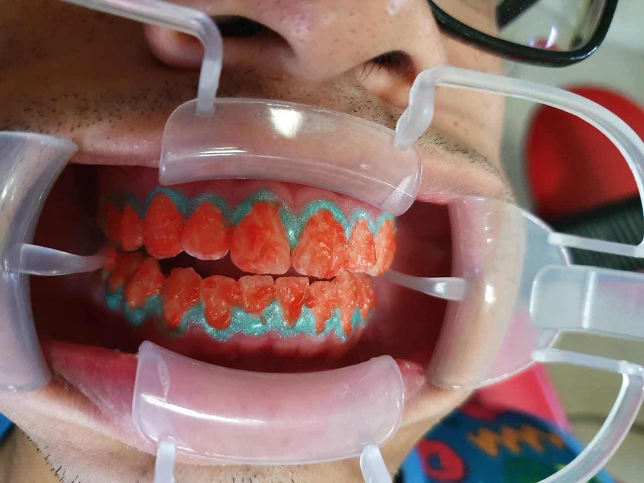 Fernando Olivier Victoriano-9