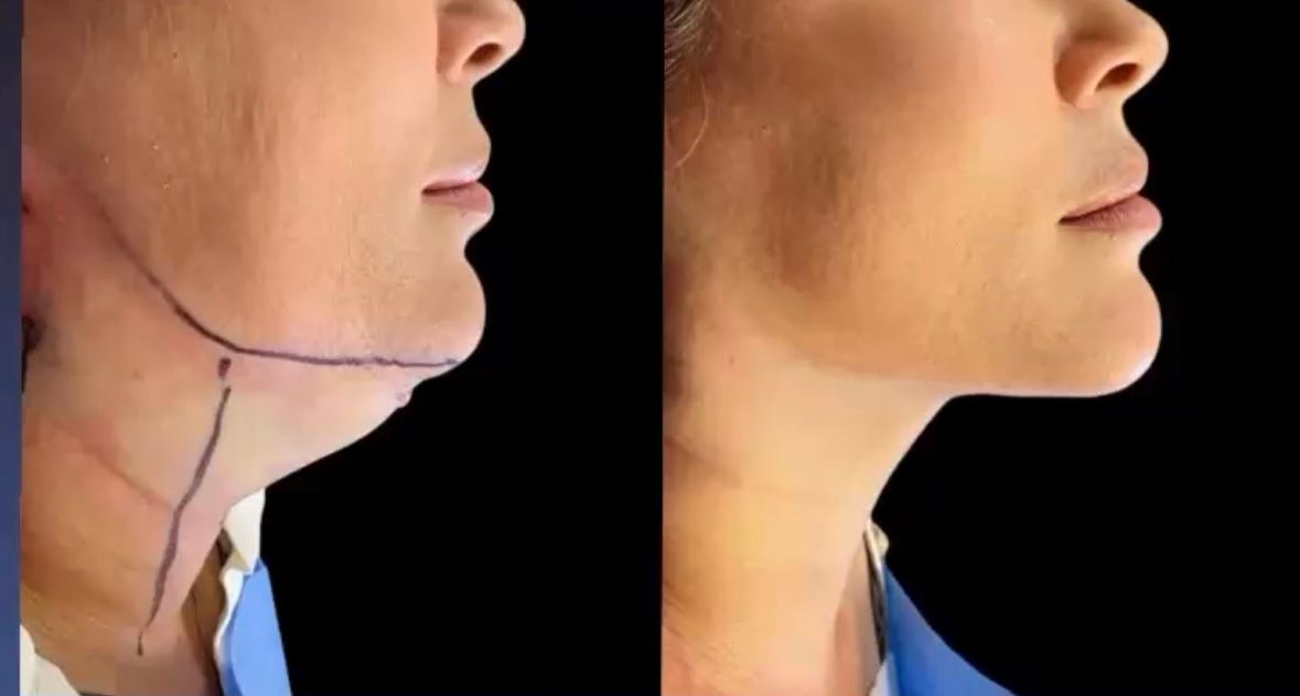 Nancy Valeria Lara Gayosso-16