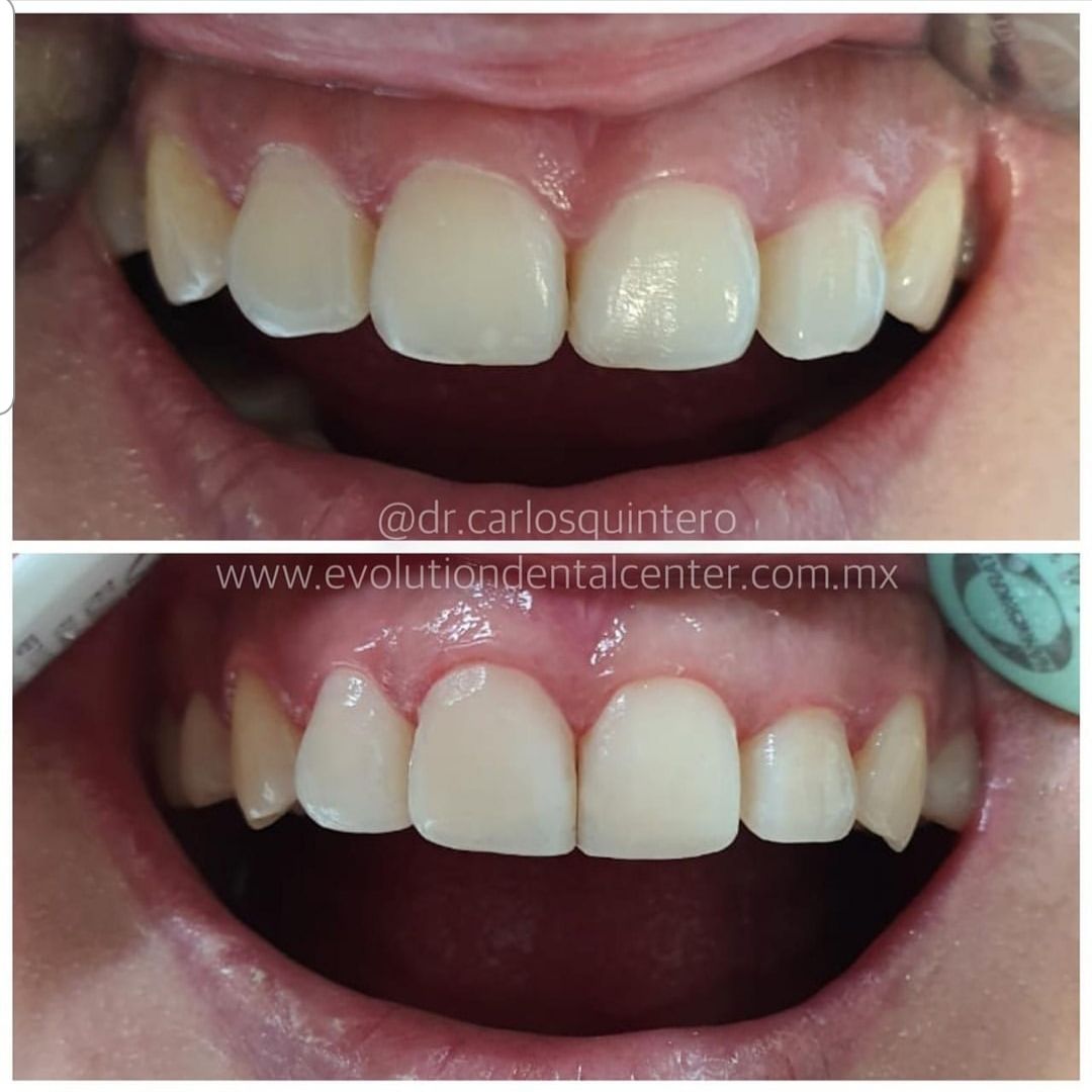 Carlos Quintero Salcedo-3