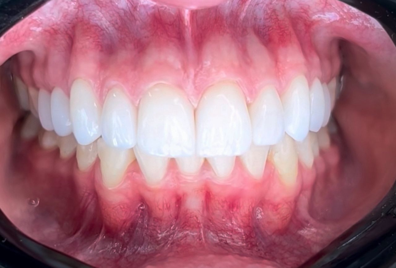 Ulises Alvarado Rodríguez-22