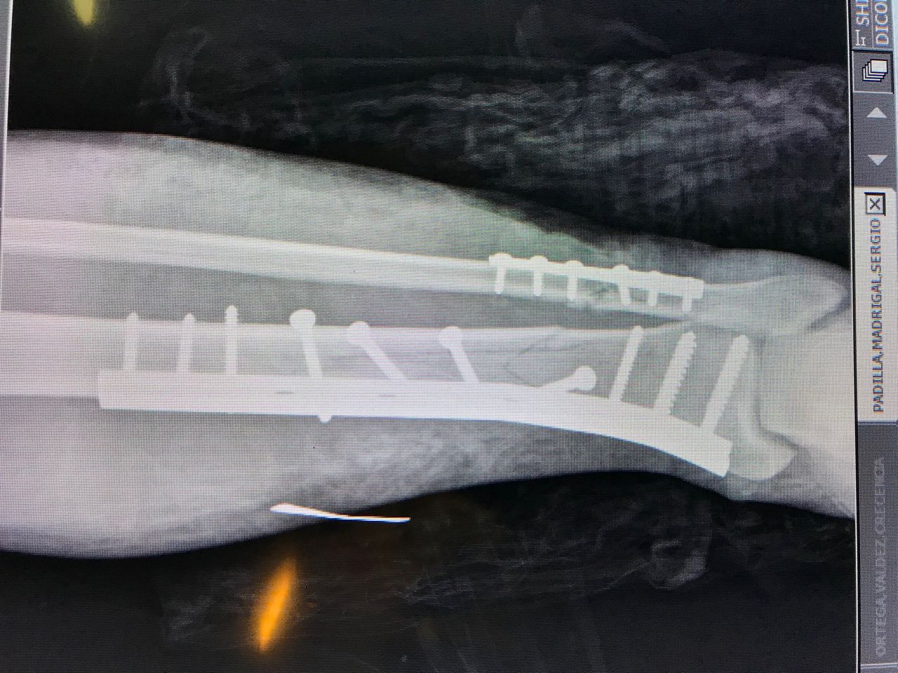 Julián Hernández Anaya-4