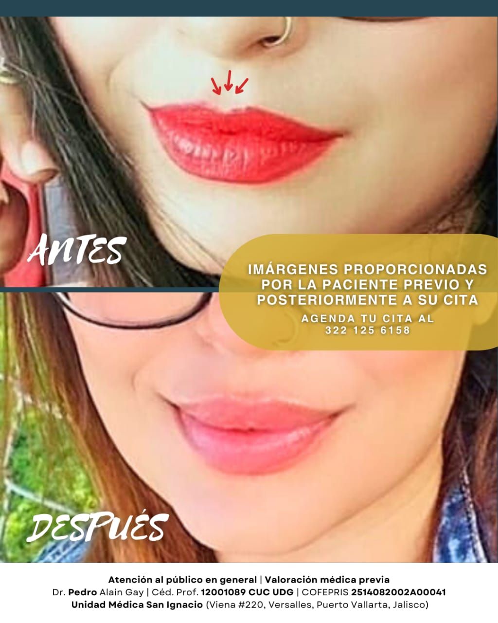 Pedro Alain  Gay Hernández -10