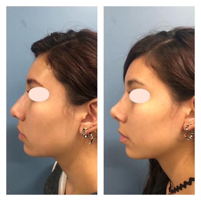 Carola Berenice Curiel Davalos-36