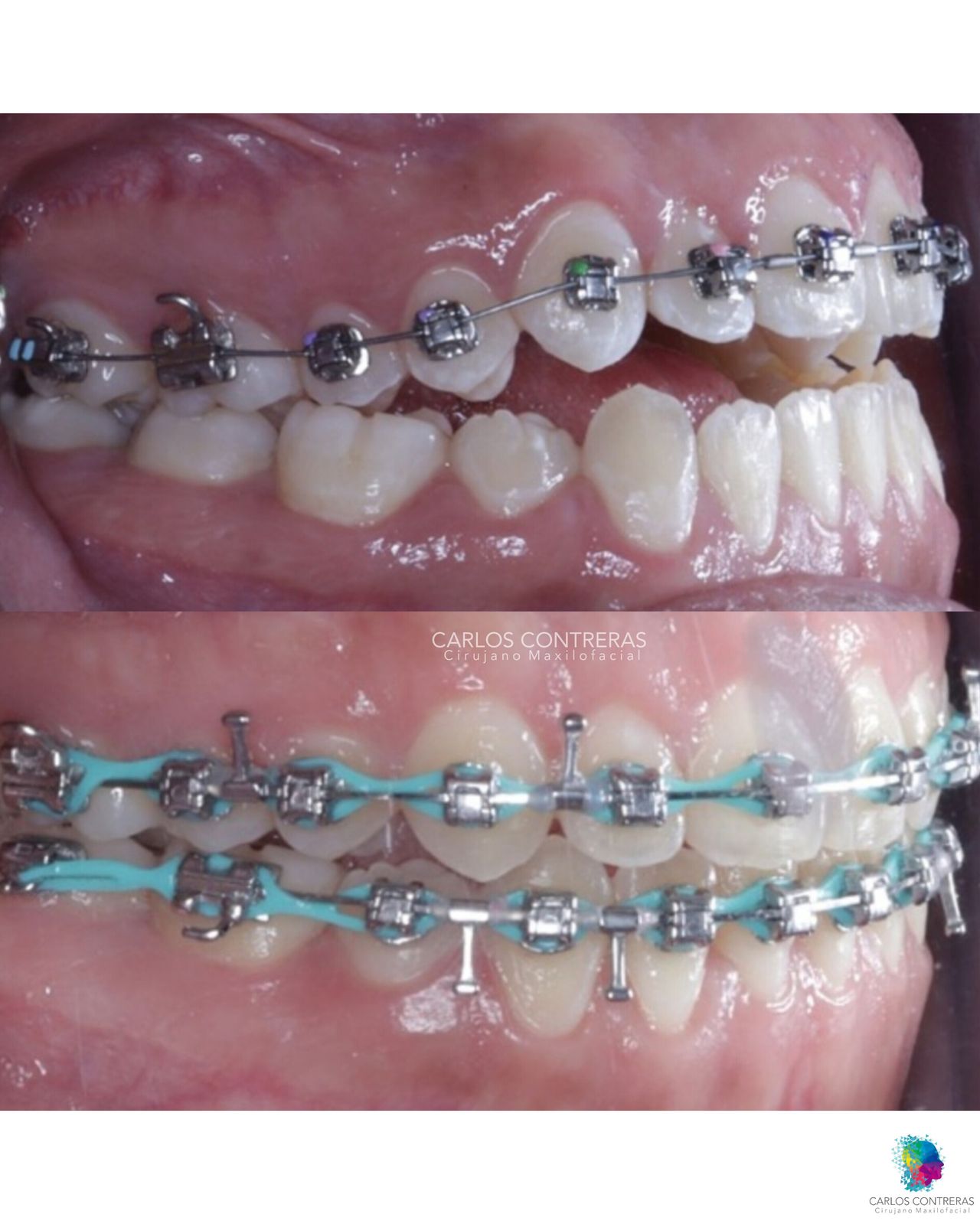 Carlos Ernesto Contreras Castellanos-34