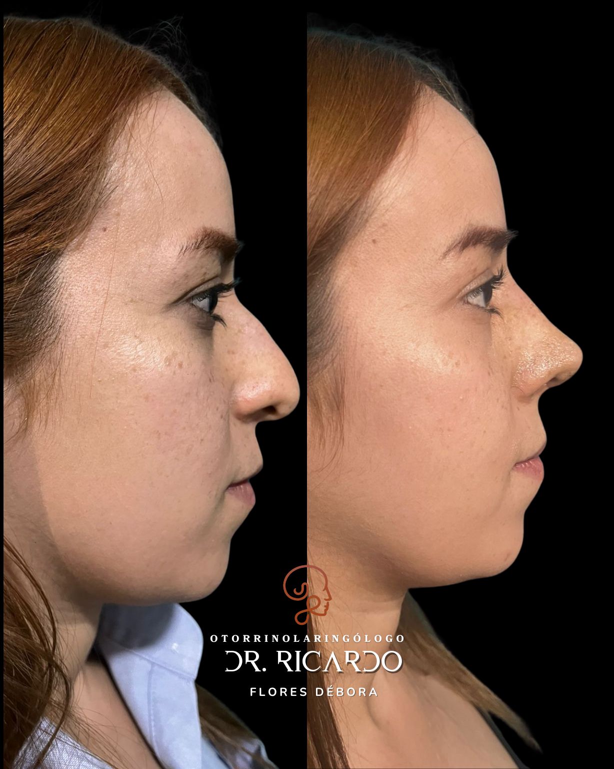 Ricardo Flores Débora-0