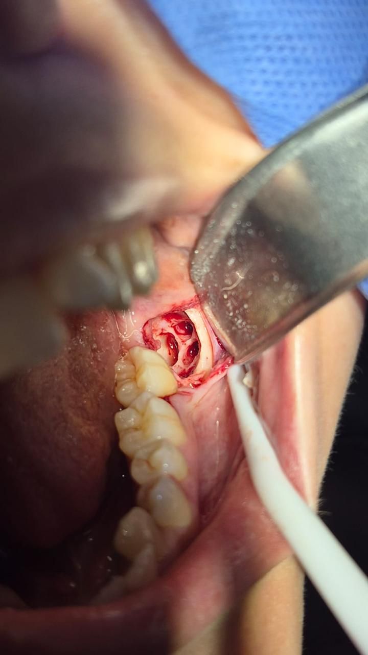 Rodolfo R. Subero Testani-13