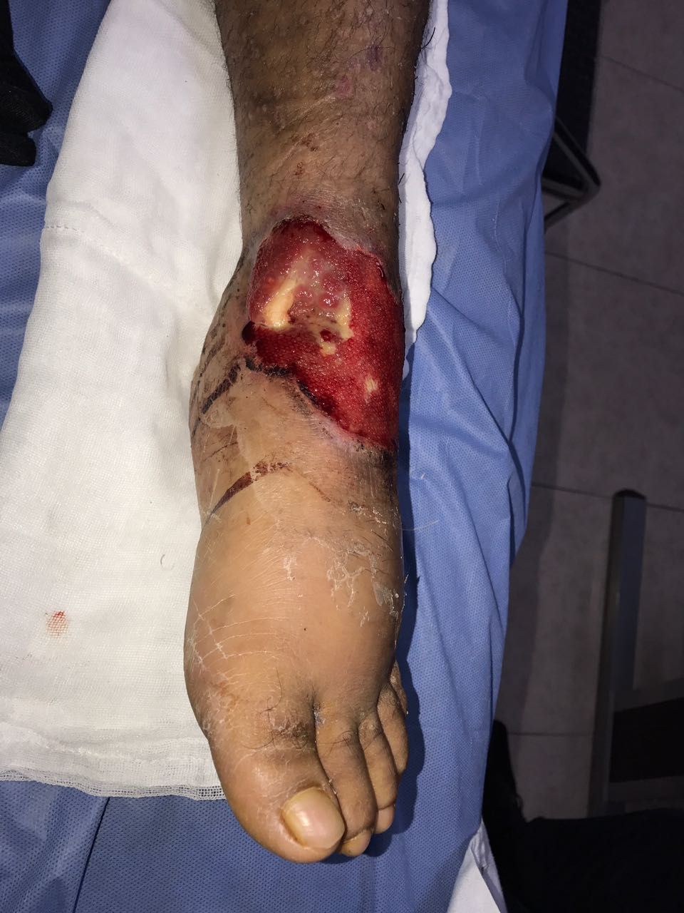 Norma Izchel Orozco Aponte-6