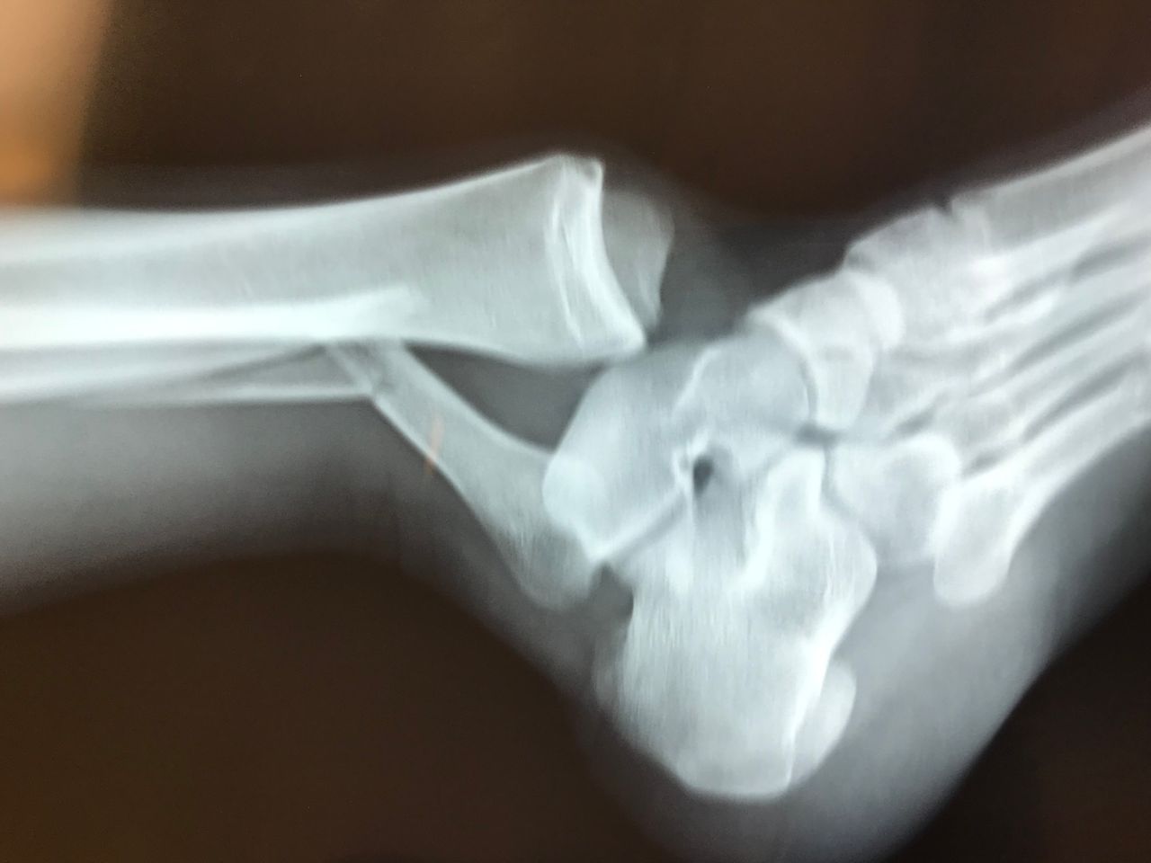 Carlos Alberto Romero Sosa-6