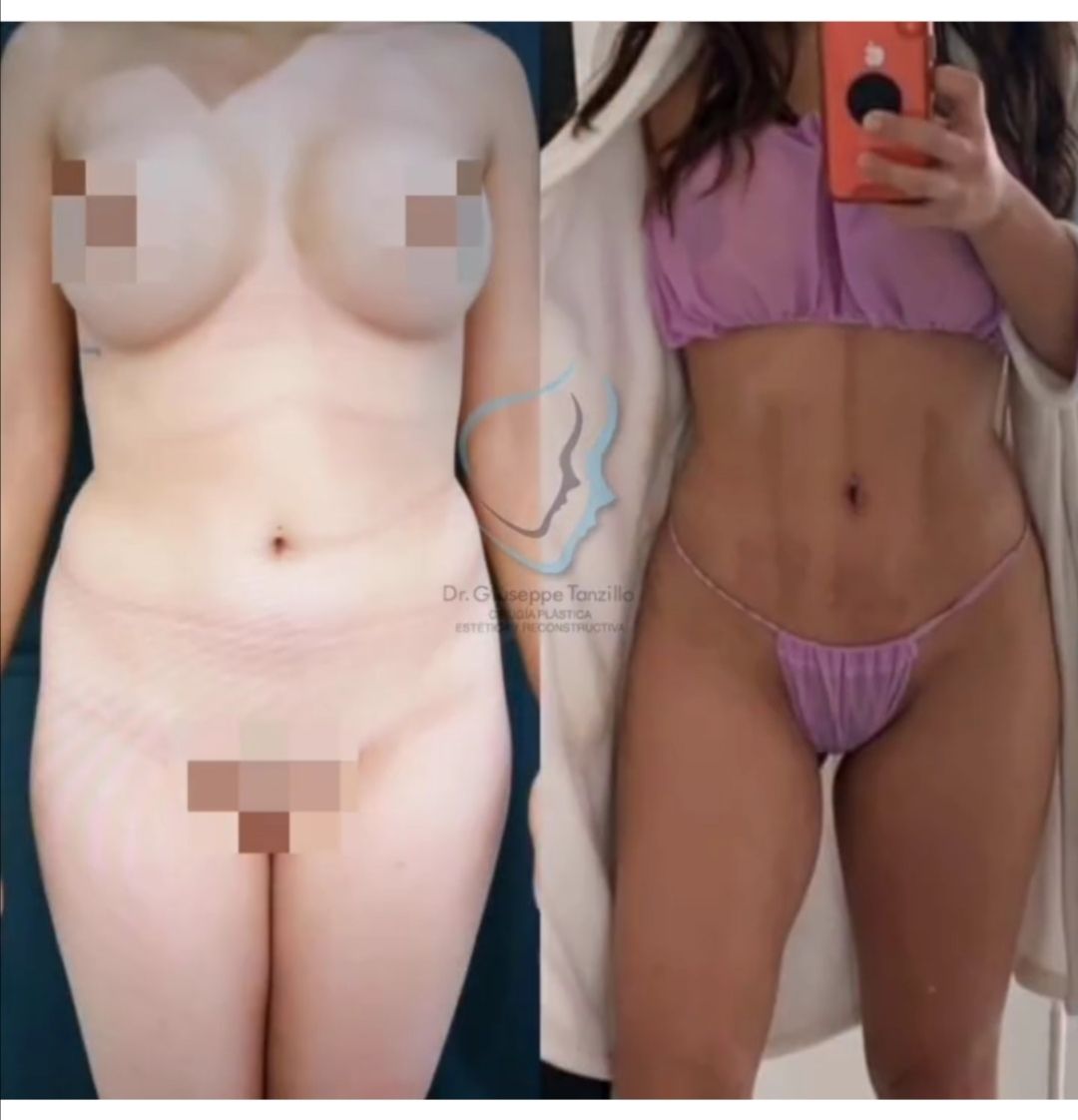 Giuseppe Tanzillo-30