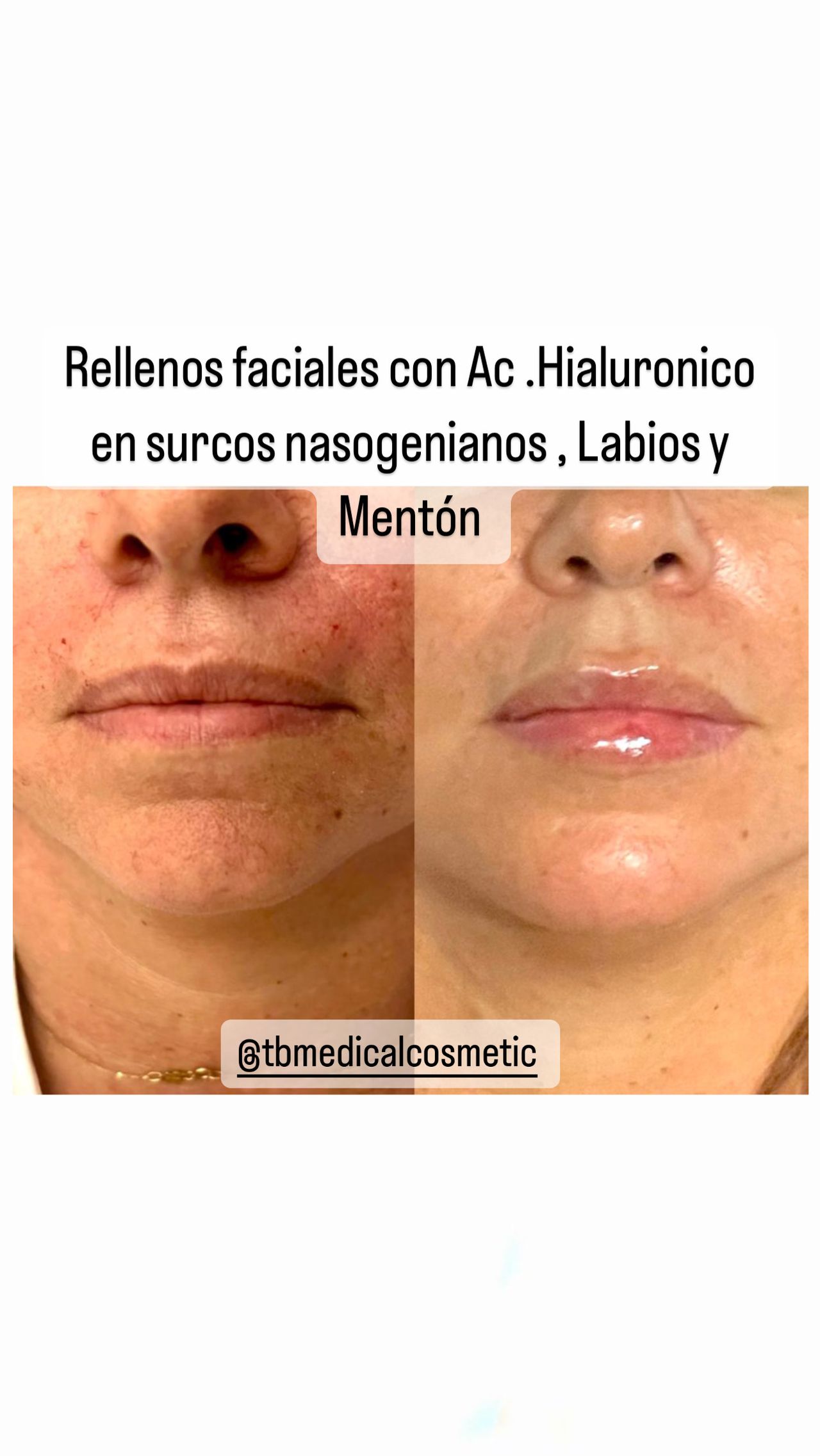 Tamara Milagros Burgos Fonseca-6