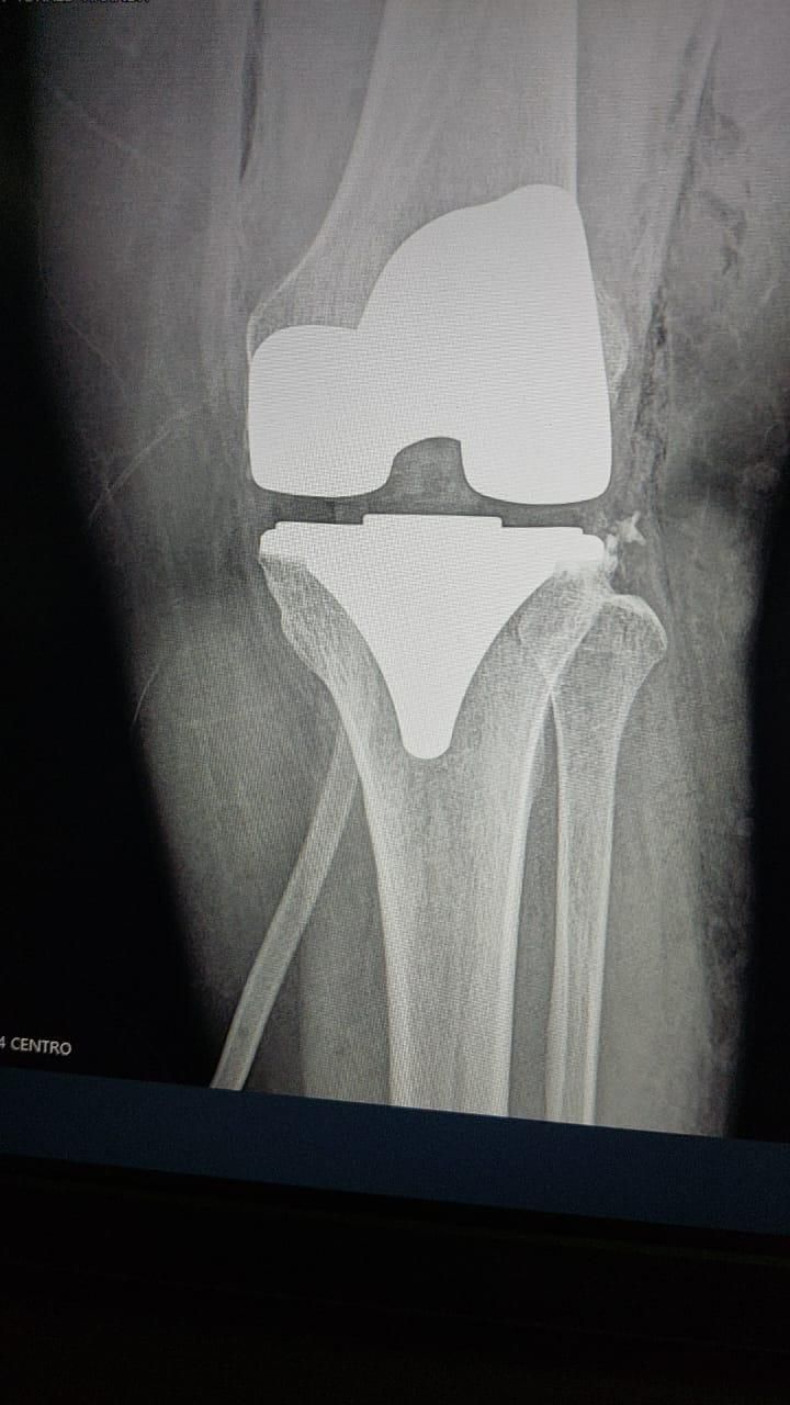 Juan Pedro Martínez Ávila-3