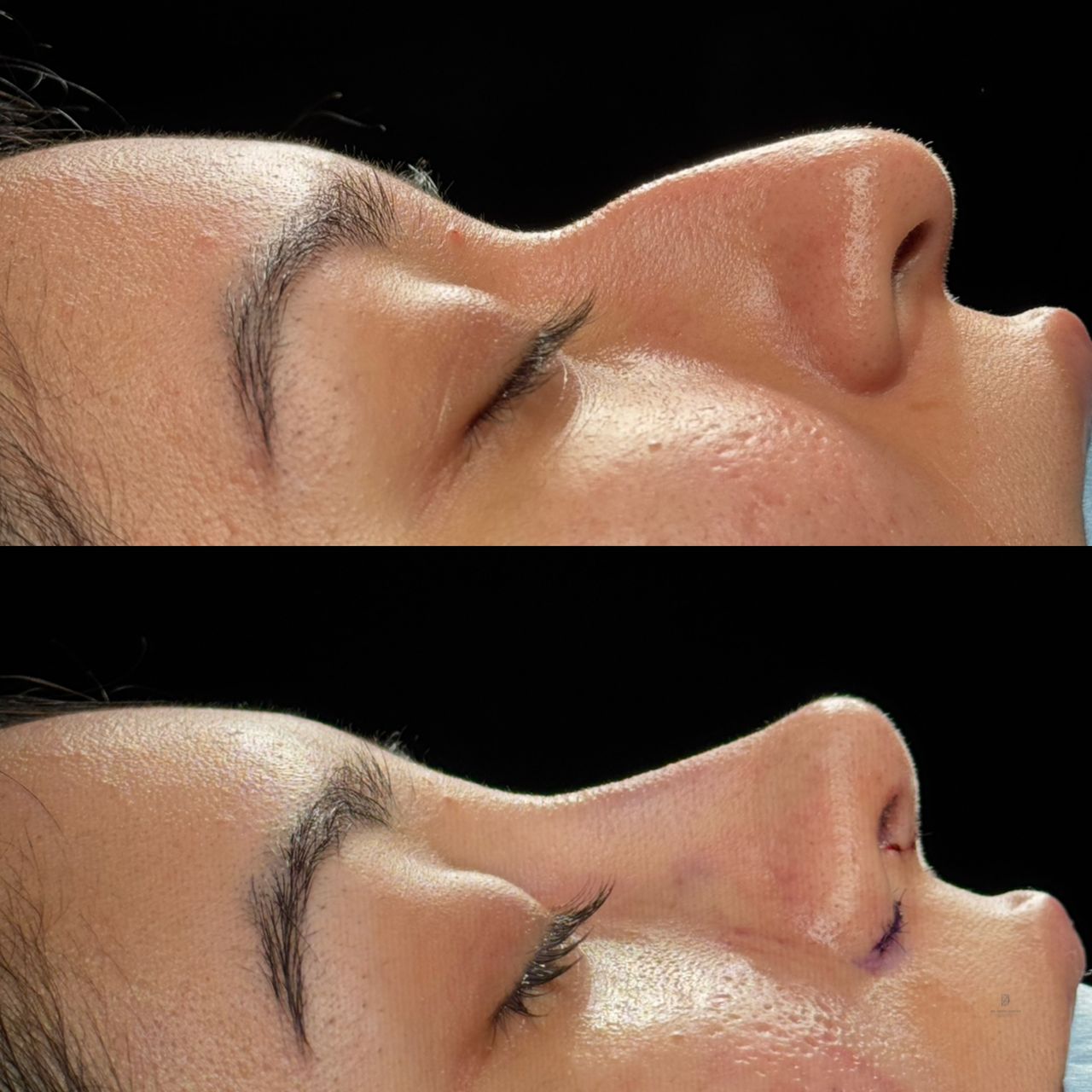 Angel Castro Urquizo-222