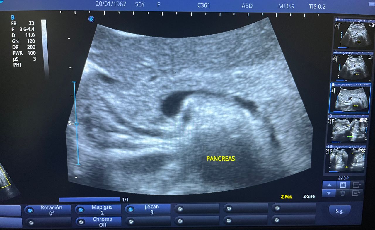 César Guerra Martínez-32