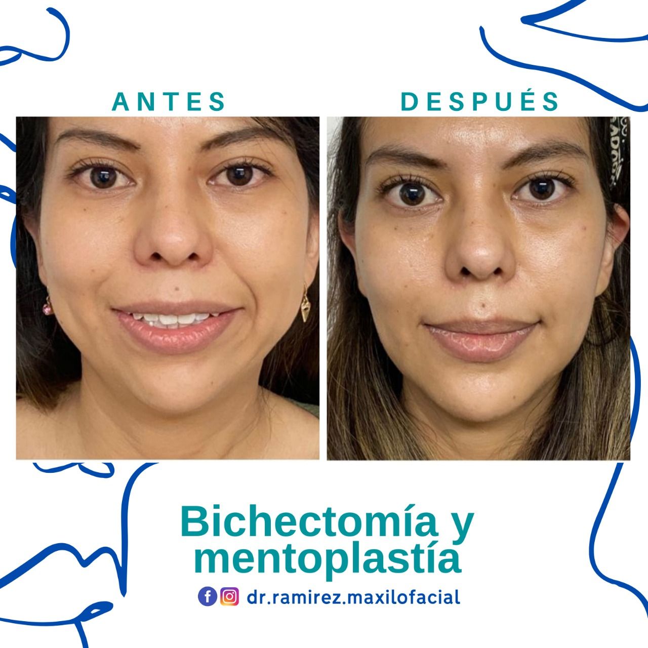 Giovani Ramírez Limón-23