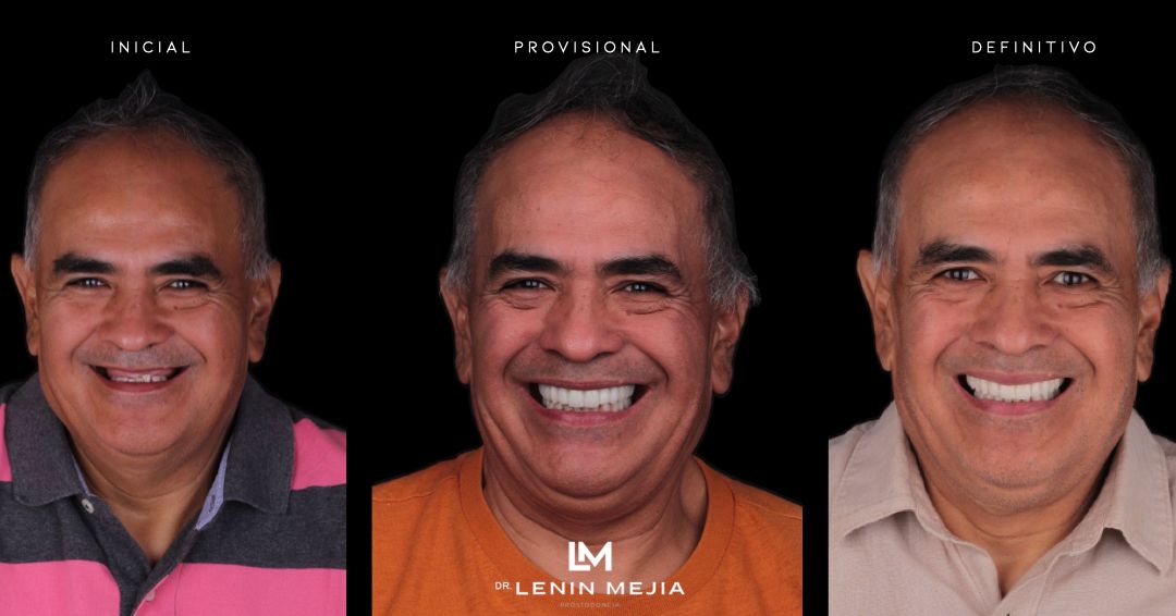 Lenin Mejia-2