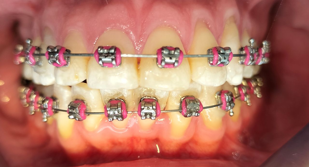 Yaneth Gutiérrez Sánchez-32