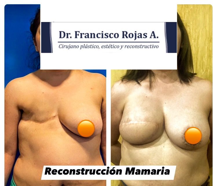 Francisco Rojas Aguilar-10