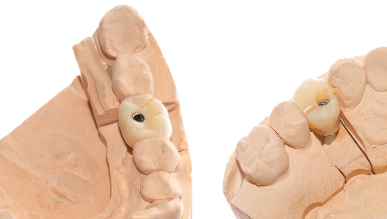 Aide Montserrat Orozco Gutierrez-35