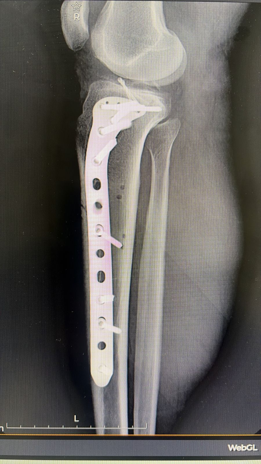 Alejandro Irisson-32