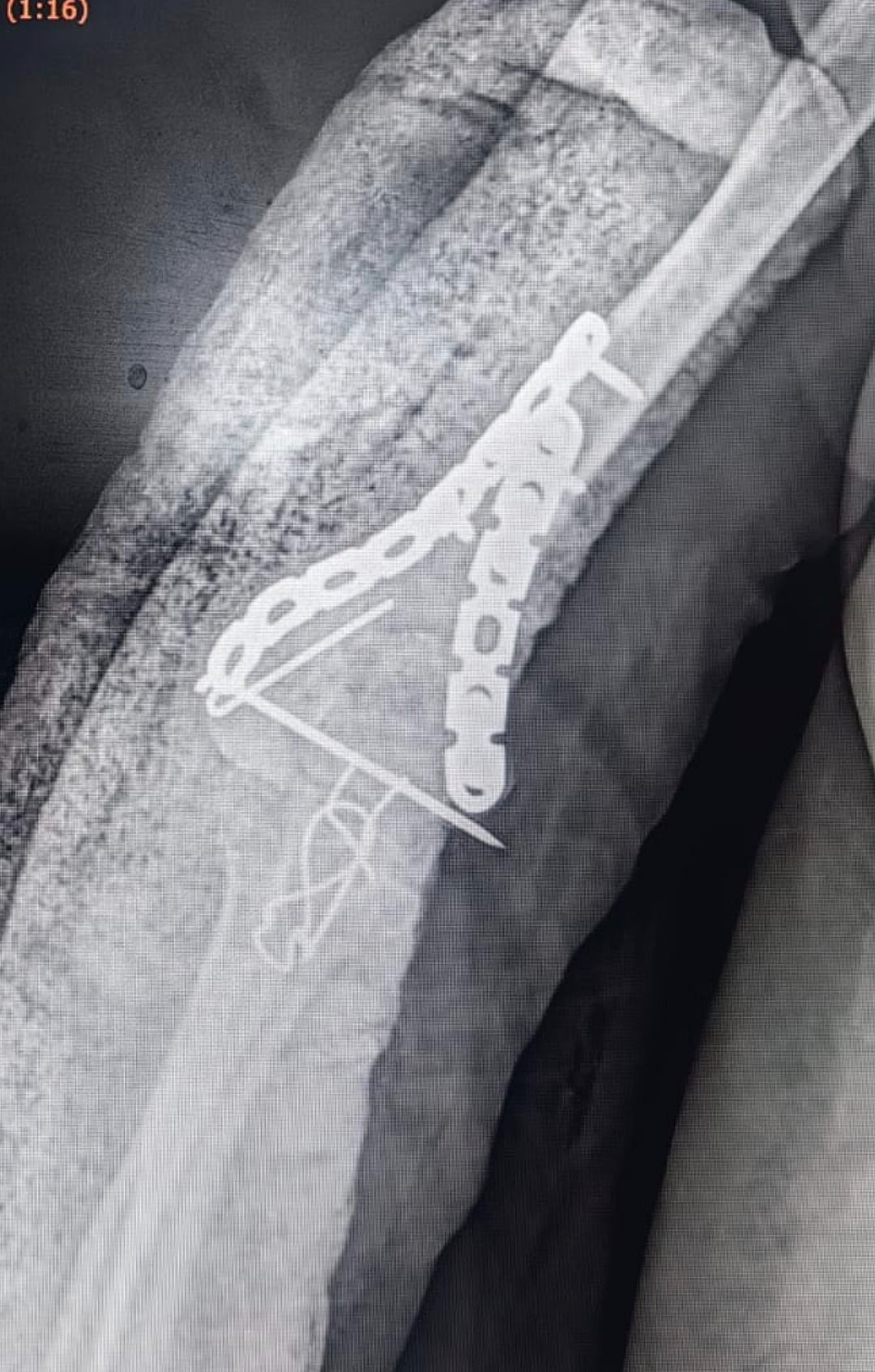 Jorge Eduardo Soto Pérez-4