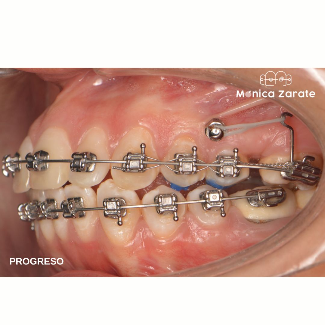 Mónica Isabel Zárate Pérez-13