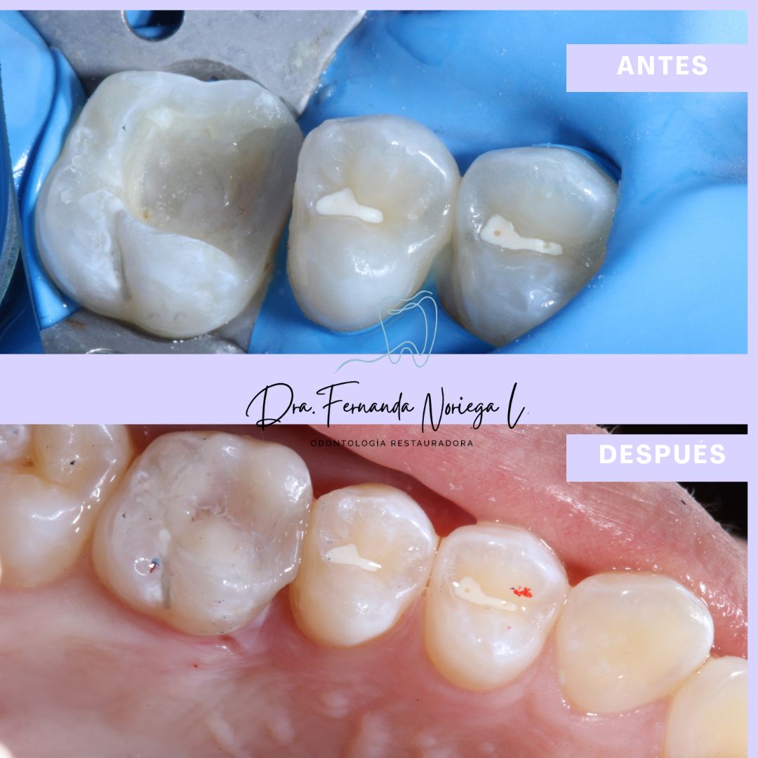 Fernanda Noriega Limón-11