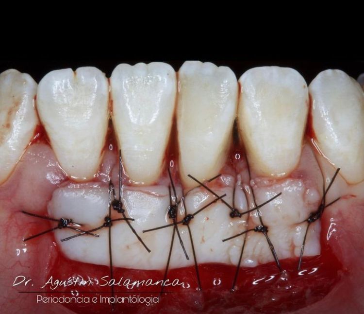 Agustin Salamanca Tapia-25