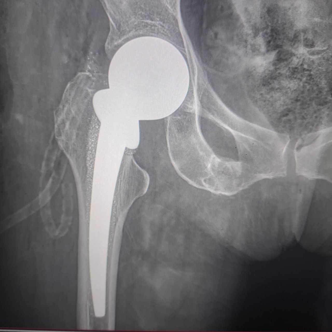 Carlos Eduardo Chairez Leyva-3