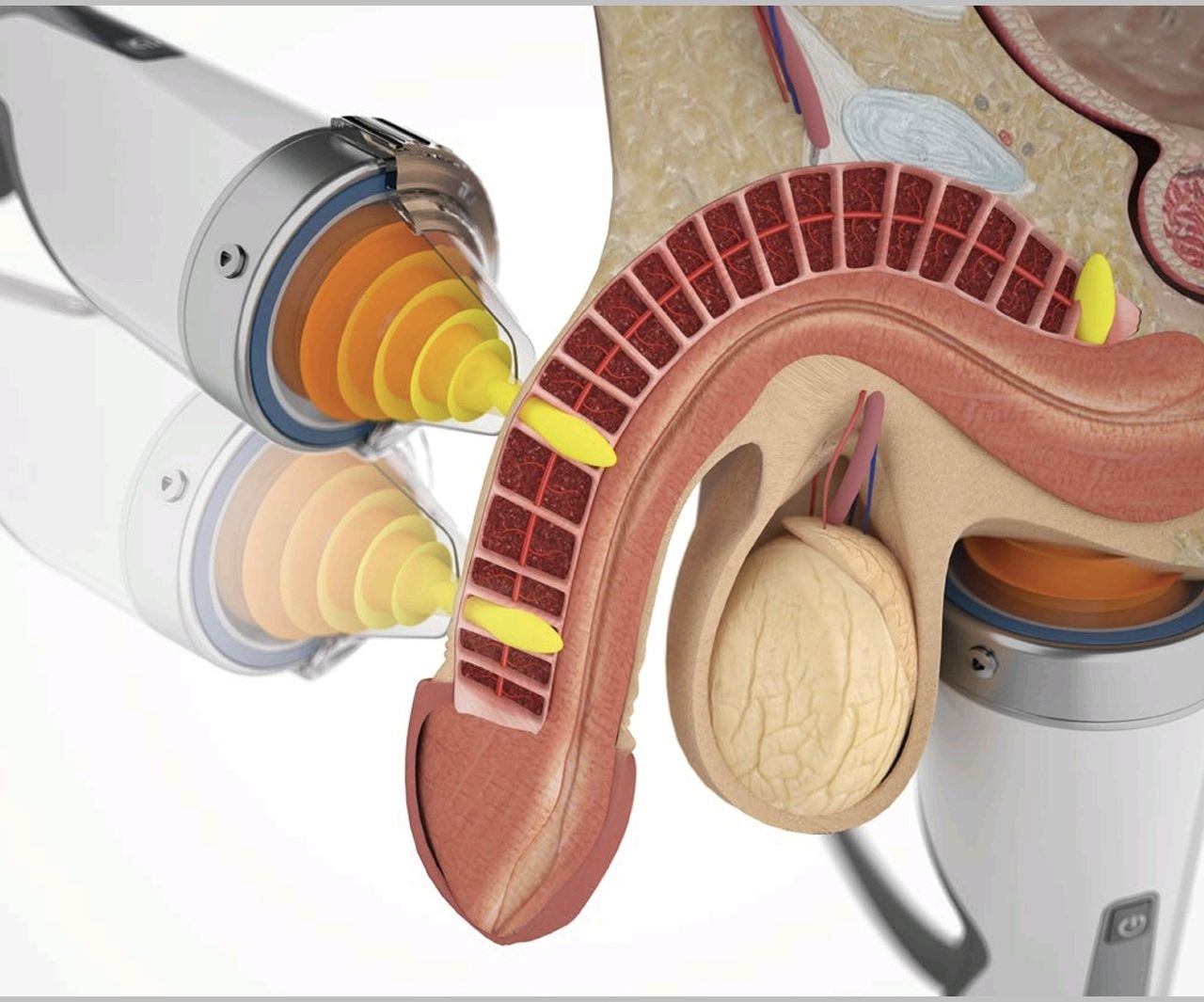 Ángel Armando Gutiérrez Jiménez-3