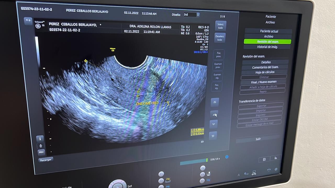 Luis Miguel Campos Olmedo-19