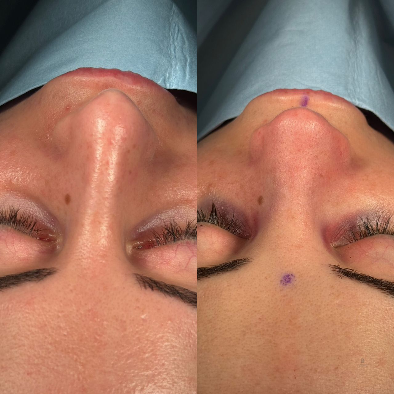 Angel Castro Urquizo-207