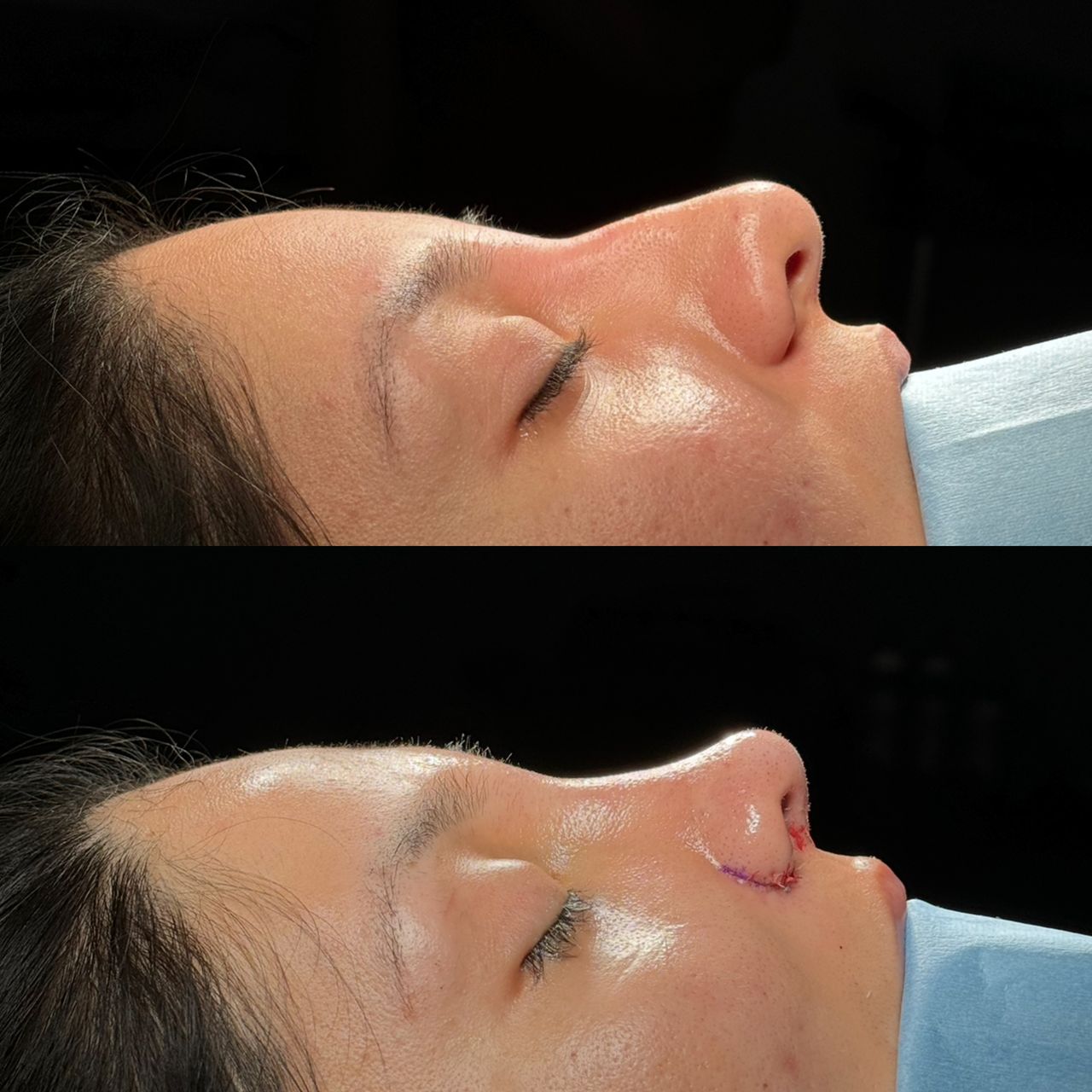 Angel Castro Urquizo-82