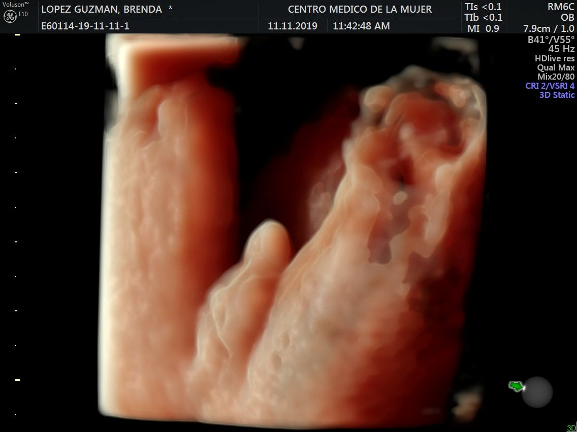 Julio Cesar Monárrez Martín-17