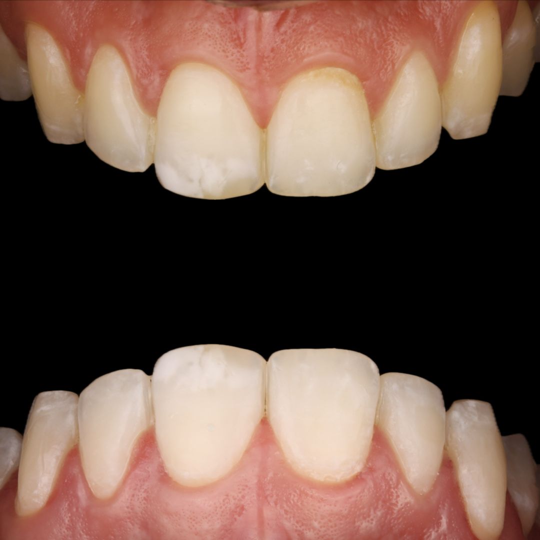 Miguel Alberto Escalona Mora-1