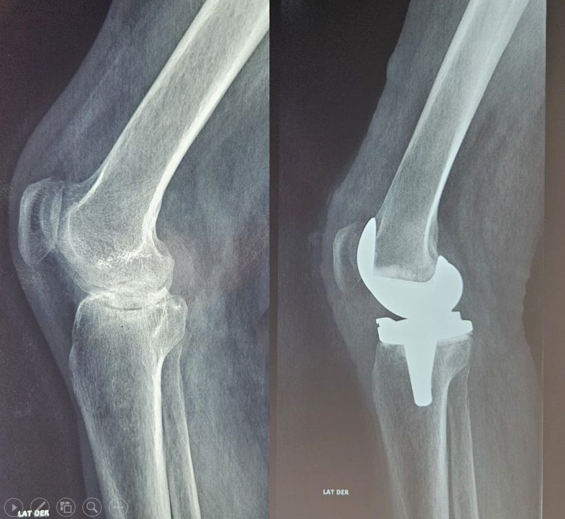 Luis Castañón Robles-2