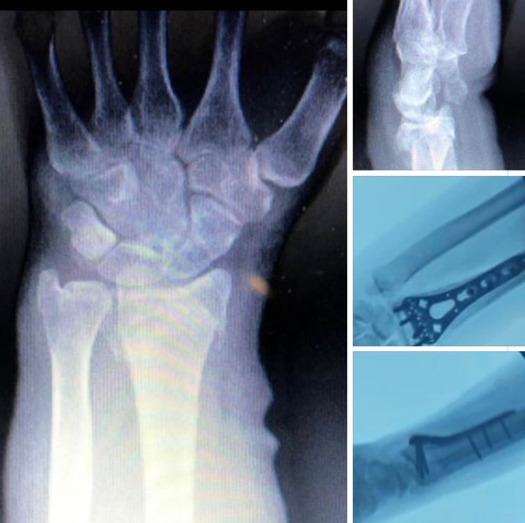 Alejandro Hernandez Frias-9