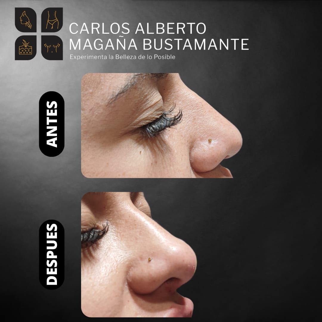 Carlos Alberto Magaña Bustamante-21