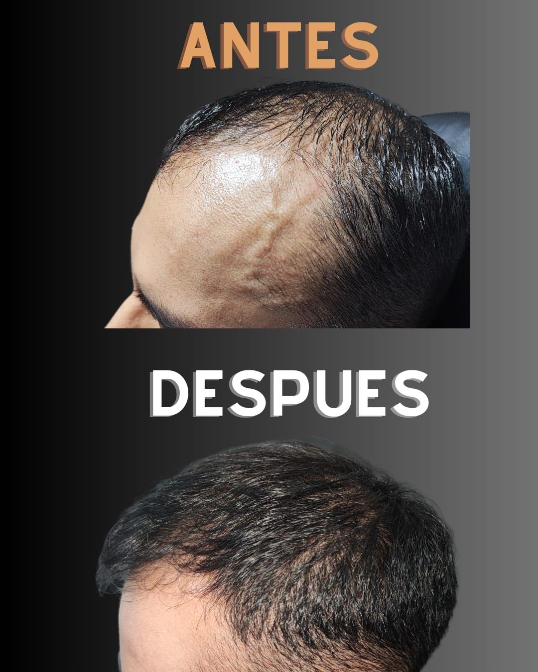 Carlos Alberto Magaña Bustamante-54