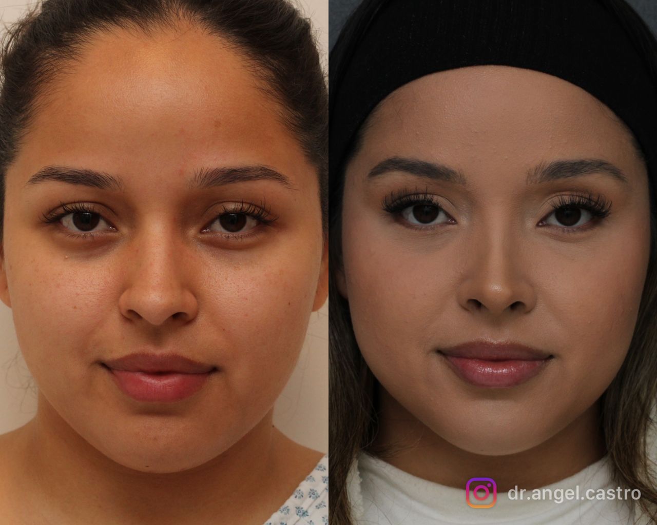 Angel Castro Urquizo-77