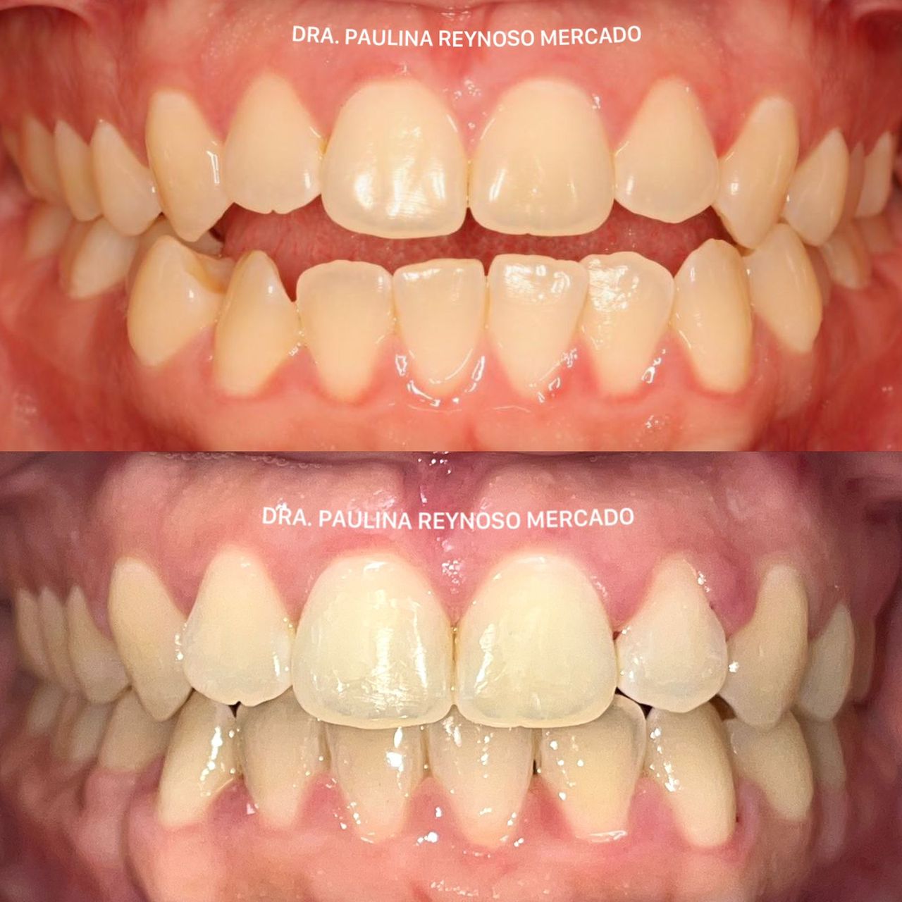 Paulina Reynoso Mercado-0