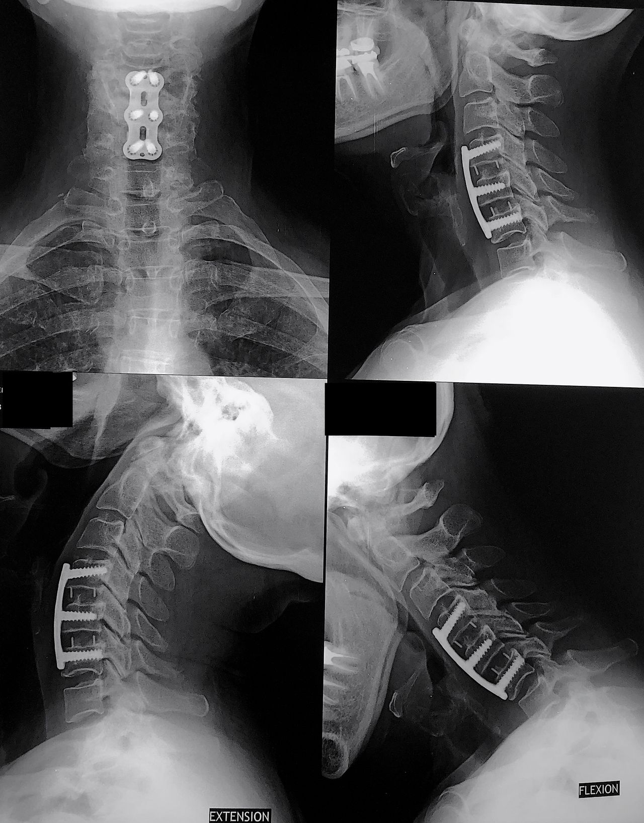 Jesus Rocha Maguey-0