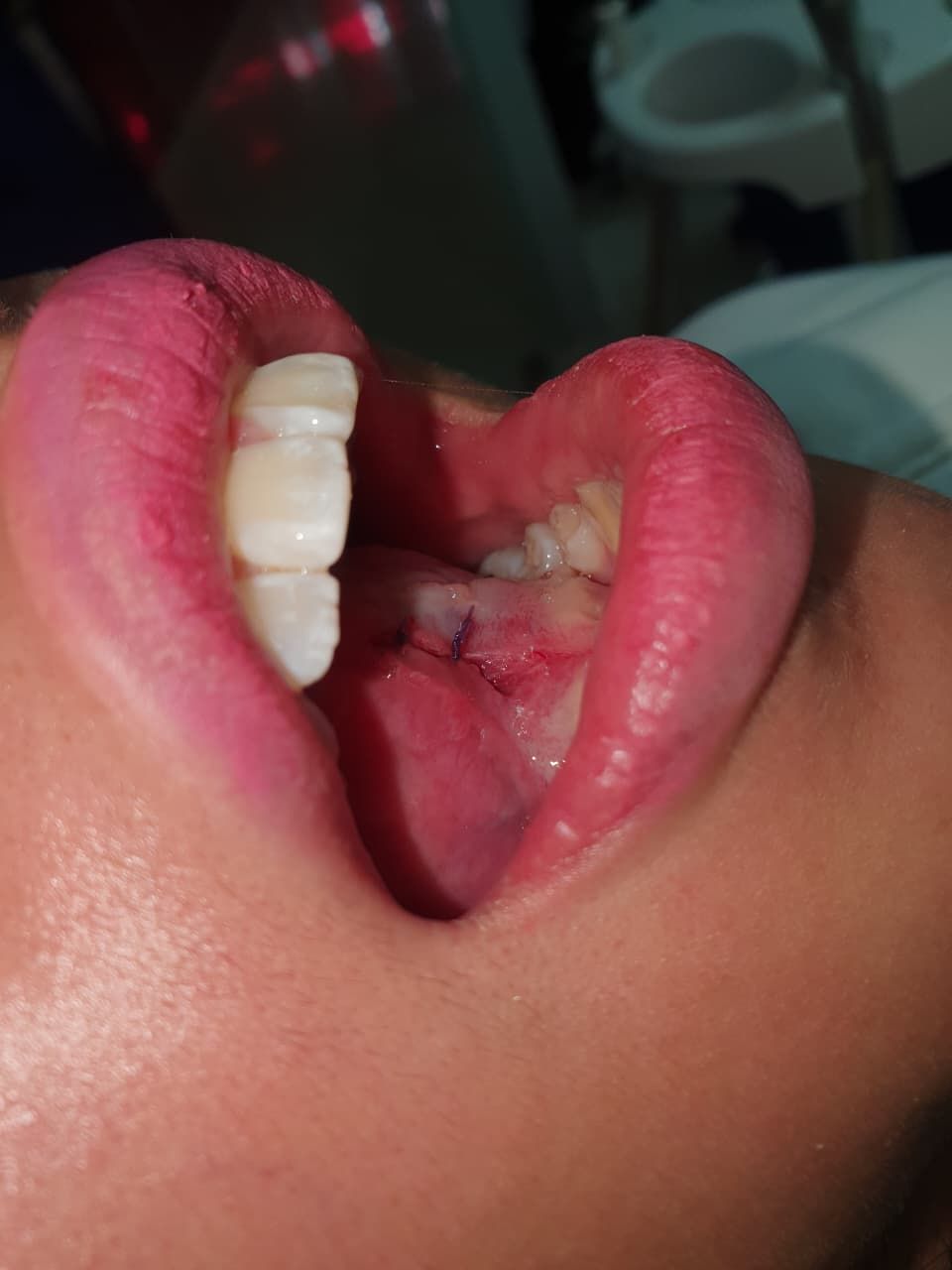 Fernando Olivier Victoriano-5