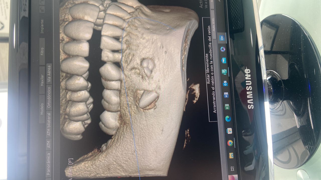 Joaquin Moguel Del Rivero-2