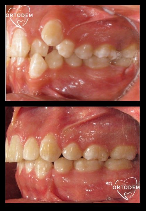 Elizabeth Morelos Morales-5