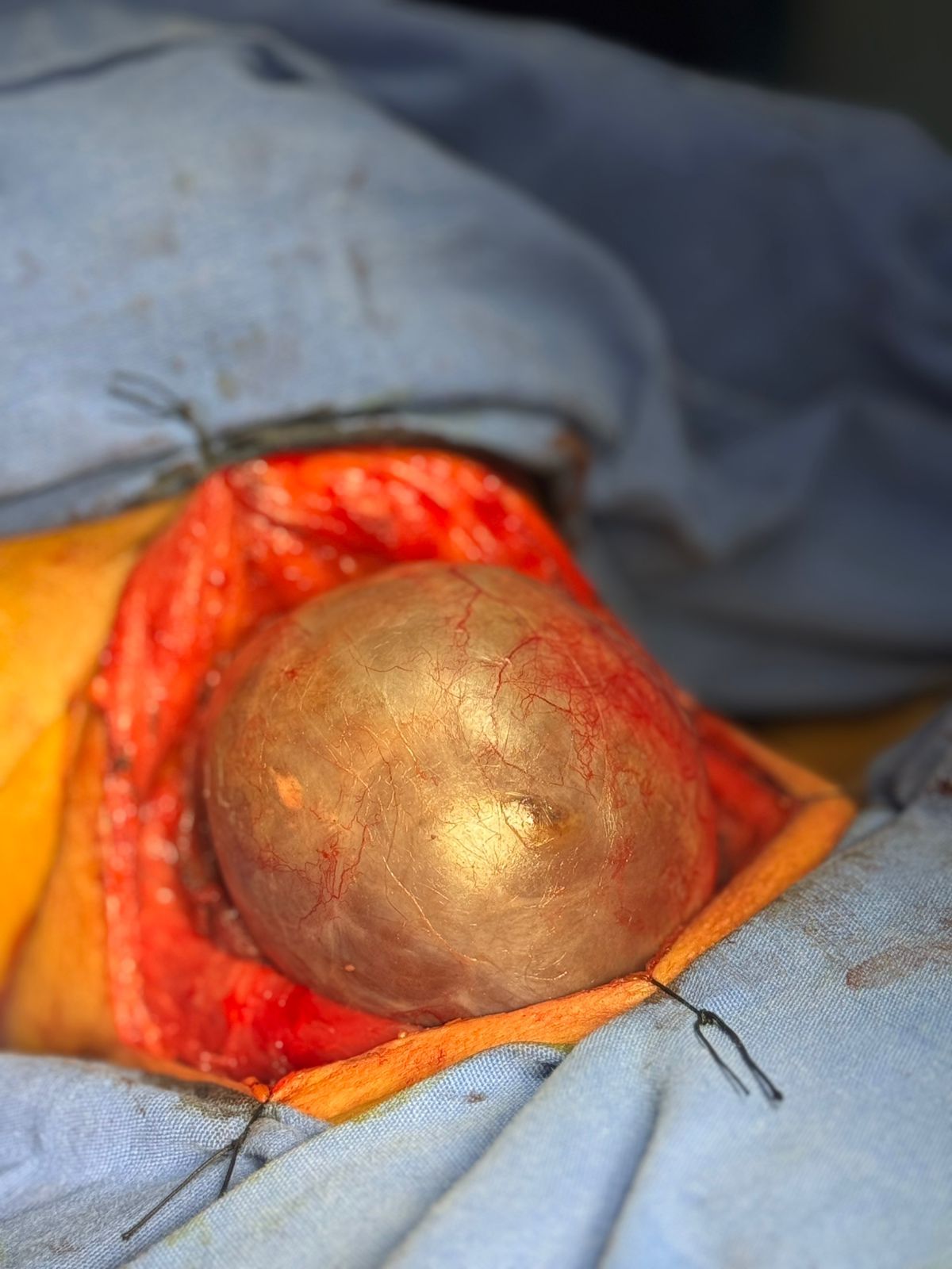 Efrain Ralero Castello-19