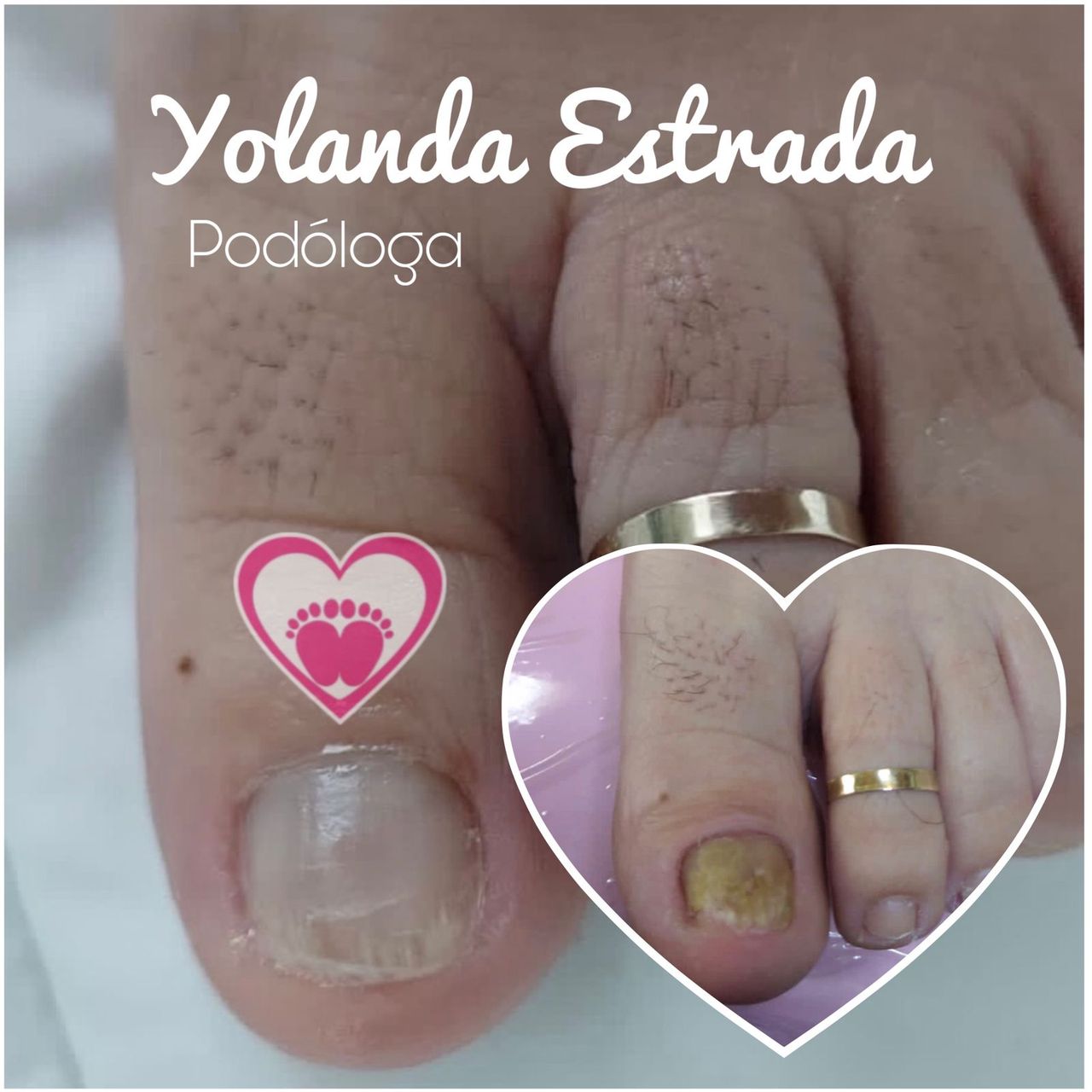 Yolanda Estrada-16